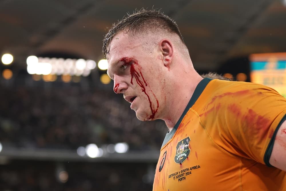 Angus Bell sports a nasty cut on his return to Test footy. Photo: Getty Images